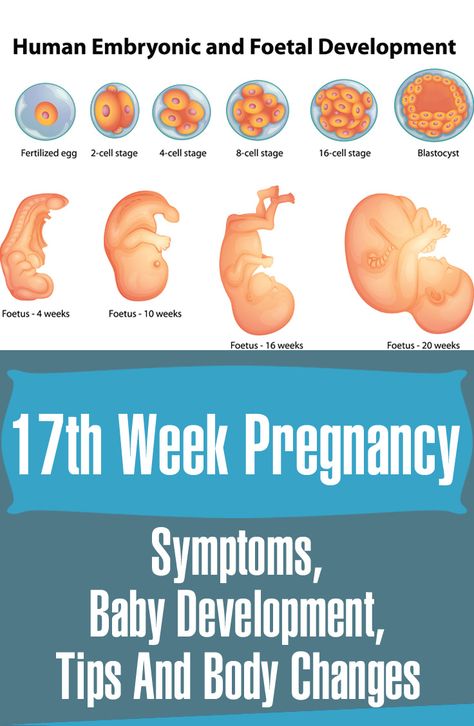 17 Weeks #Pregnant - Symptoms, Baby Development, #Tips And Body Changes 15 Weeks Pregnant Belly, Pregnant Symptoms, 17 Weeks Pregnant, 11 Weeks Pregnant, 15 Weeks Pregnant, Sperm Donor, Fetal Development, Pumping Moms, Baby Sleep Problems