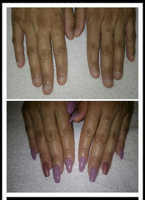 Before and after Small nail beds.  Acrylic nails Acrylics On Short Nail Beds, Before And After Nails, Flat Nail Beds, Small Nail Beds, Wide Nail Beds, Short Nail Bed, Long Nail Beds, Pretty Nails Glitter, Wide Nails