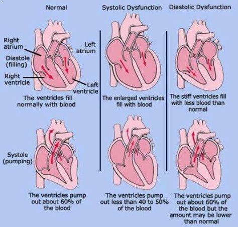 Cardiovascular System Notes, Fitness Poster Design, Heart Things, Fitness Poster, Medical Mnemonics, Cardiac Nursing, Blood Pressure Chart, Blood Pressure Cuff, Nursing Education