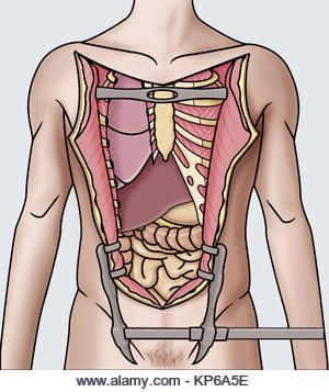 Anatomy Drawing Medical Images, Blood Donation, Anatomy Drawing, Hand Art Drawing, Image Collection, Royalty Free Photos, Cyberpunk, Anatomy, Stock Images