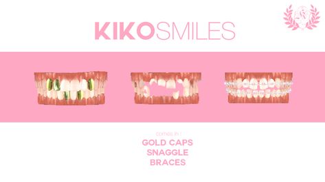 Kiko Smiles: Realistic Teeth (Gold Caps, Snaggle & Braces)🦷 Sims 4 Teeth Cc, Sims 4 Family, The Sims 4 Skin, My Sims, Sims 4 Cc Makeup, Sims 4 Game Mods, Sims 4 Body Mods, Sims 4 Expansions, Tumblr Sims 4