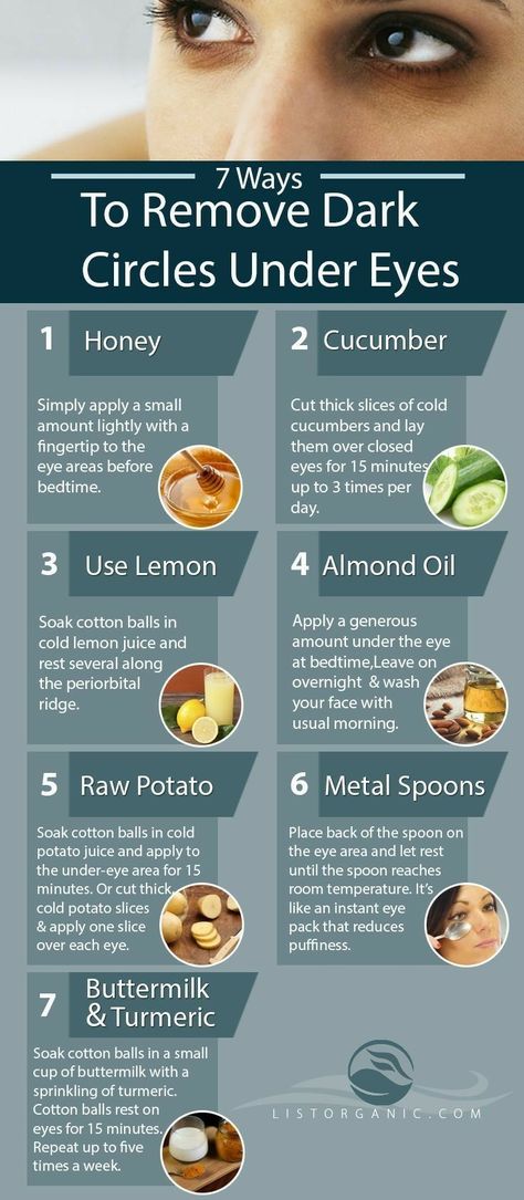 Dark Eyes Remedies, Almond Oil For Dark Circles, Dark Undereye Circles Remedies, How To Get Rid Of Dark Eyelids, How To Get Rod Of Dark Circles Under Eyes, How To Fix Dark Circles Under Eyes, Undereye Darkness Remedy, Eyebags Remedy Under Eyes, Eyebags Remedy