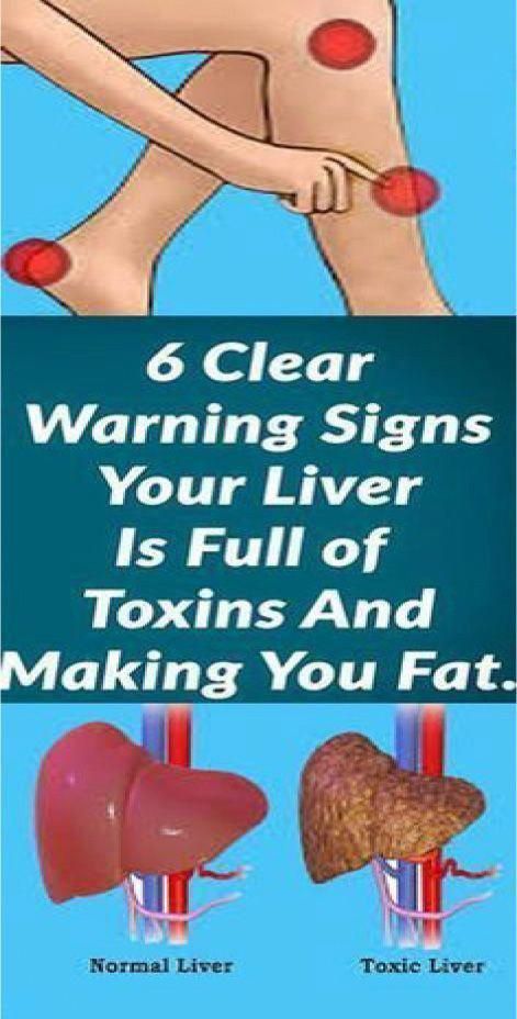 Quadrants Of The Abdomen, Liver Issues, Recipe Hacks, Tips For Acne, Itching Skin, Liver Diet, Acne Dark Spots, Keto Diets, Liver Detox