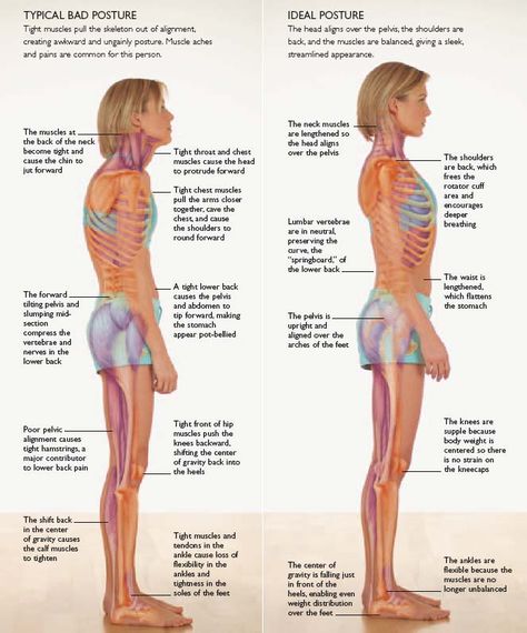 Posture Fix, Bolesti Chrbta, Posture Exercises, Coconut Health Benefits, Bad Posture, Poor Posture, Posture Correction, Muscle Aches, Hip Flexor