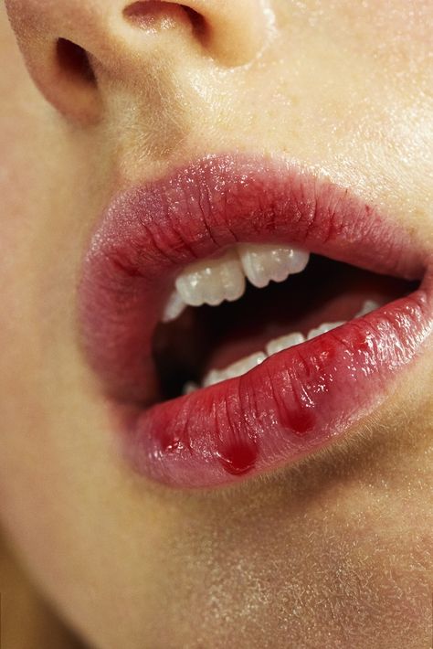 LUNDLUND : ANNE STAUNSAGER Mouth Photography, Body Study, Gap Teeth, Blood Art, Study Photography, Body Shots, Sketches Simple, Model Face, Beauty Shots