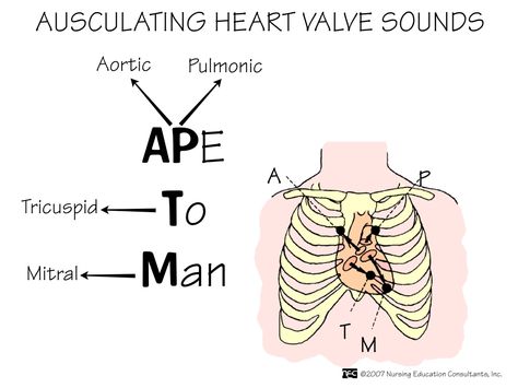 Auscultating heart valve sounds...good little trick to remember! Med Student Humor, Cardiac System, Nurse Ratchet, Nurse Tips, Nursing 101, Nursing Board, Med Surg Nursing, Nursing Assessment, Heart Sounds