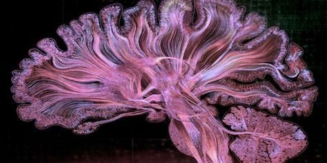 Neuroscientists combined a variety of techniques—drawing, optical engineering, and gold-etching—to create this artistic depiction of the human brain. Greg Dunn, Neuroscience Art, Science Images, Brain Images, Human Organ, Brain Scan, Brain Art, Microscopes, Medical Art