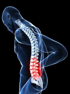 Geeta Healing: Astrology of  Slipped Disc Medical Astrology, Cod Liver Oil, Low Back Pain, Shoulder Pain, Medical Prescription, Neck Pain, Chiropractic, Medical Conditions, Chronic Pain