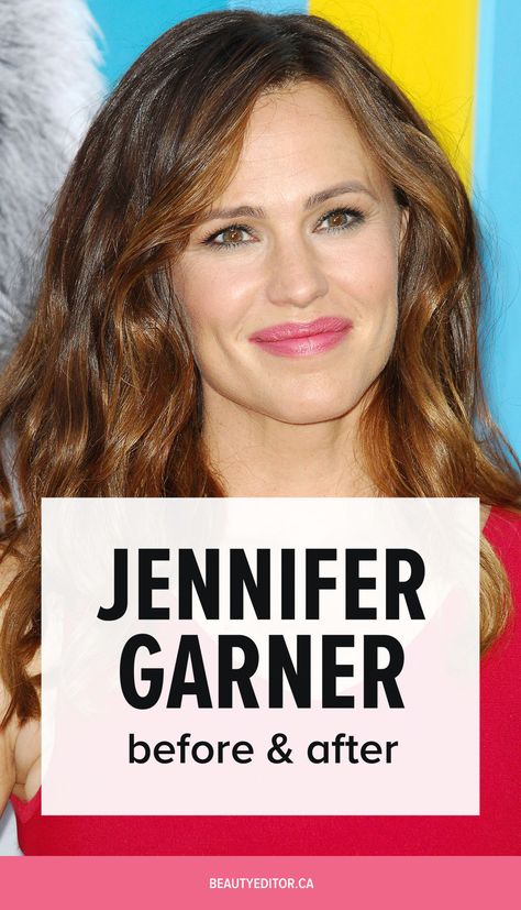 Jennifer Garner Hair, Jennifer Garner Style, Celebrities Before And After, Trending Haircuts, Jennifer Garner, New Haircuts, Plastic Surgery, Skincare Routine, Hair Looks