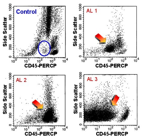 Flow Cytometry Analysis, Dot Plot, Flow Cytometry, Medicine Notes, B Cell, Medical Laboratory Science, T Cell, Laboratory Science, Medical Laboratory