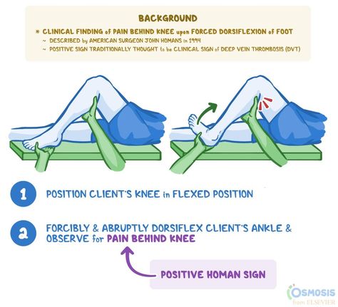 Homans Sign Nursing, Pain Behind The Knee, Homans Sign, Surg Tech, D Dimer, Heart Journal, Medicine Journal, Muscle Spasms, Nursing Notes