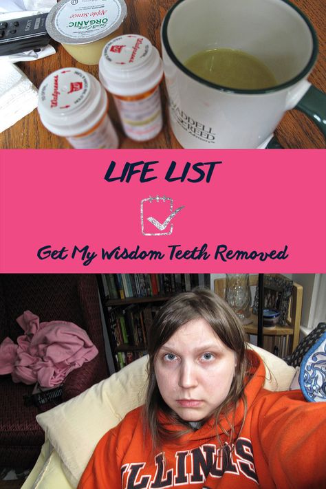 LIFE LIST - 1,000 things I want to do in my life - Get my wisdom teeth taken out. Bucket List Ideas For Teens, Diet Day 1, Wisdom Teeth Recovery, Hismile Teeth Whitening, Wisdom Teeth Funny, Teeth Illustration, Tooth Crown, Dental Implants Cost, Dentistry Student