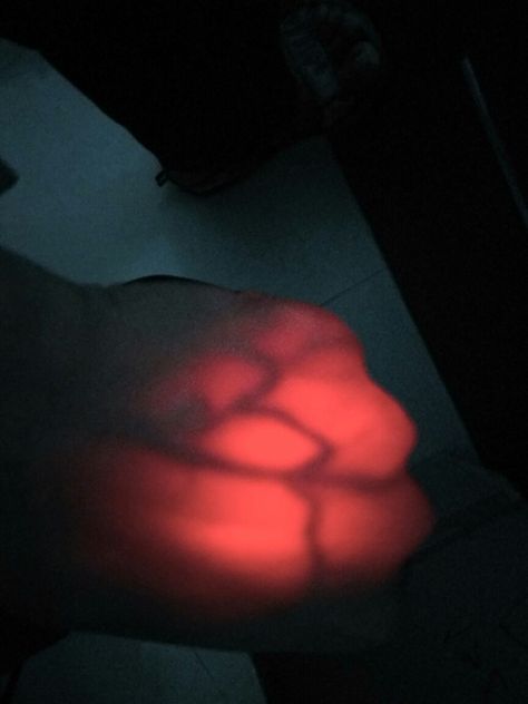 Vein Viewer Glowing Veins, Eye Veins, Red Veins, Medical Equipment, Cosplay Ideas, Master Class, Character Design, Medical, Natural Landmarks