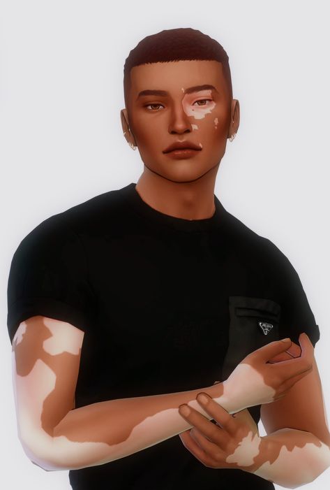 Vitilgo Sims4, Male Skinblend Sims 4, Sims 4 Cc Vilitigo Skin Patreon, Sims 4 Vitíligo Cc Patreon, Sims 4 Cc Maxis Match Skin Overlay Male, Men Cc Sims 4 Skin, Sims 4 Vitíligo Skin Cc, Sims 4 Cc Mens Skin Overlay Maxis Match, Sims 4 Vitíligo Skin Cc Patreon