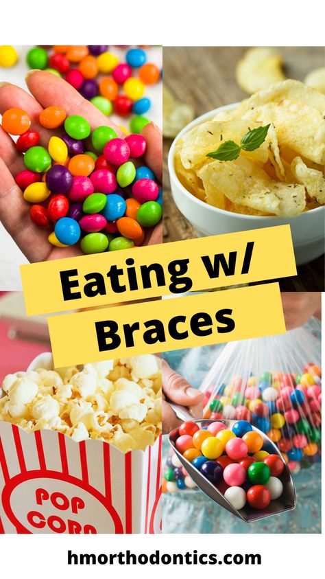 How To Prepare For Getting Braces, Snacks For Braces Ideas, Foods You Cant Eat With Braces List, Braces Party Ideas, Braces Gift Basket, New Braces Care Package, Candy You Can Eat With Braces, Foods To Avoid With Braces, Braces Off Party