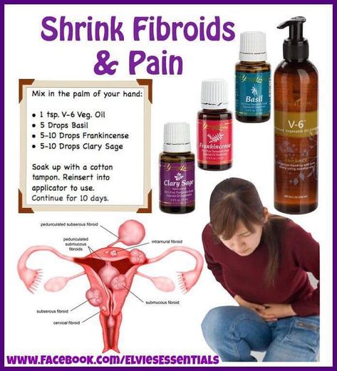 Fibroid Diet, Fibroid Uterus, Fibroid Tumors, Clary Sage Oil, Essential Oil Remedy, Oil Remedies, Essential Oils Herbs, Yl Essential Oils, Living Essentials Oils