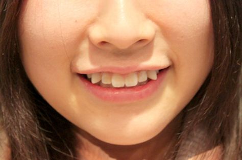 Japan’s Latest Beauty Trend: Paying Money To “Ruin” Your Teeth Cheek Piercings, Black Teeth, Crooked Teeth, Japanese Cosmetics, Photographie Portrait Inspiration, You Are Cute, Beauty Standards, Cosmetic Dentistry, Pale Skin