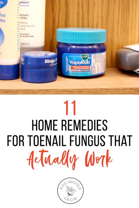 Foot Fungus Remedies, Fungal Infection Remedies, Toenail Fungal Infection, Nail Remedies, Fingernail Fungus, Toenail Fungus Remedies, Nail Infection, Nail Fungus Remedy, Fungal Nail