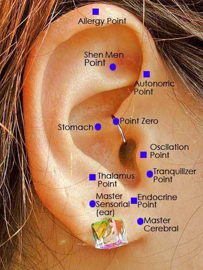 Pinner: Acu staple- You have a small staple inserted on a pressure point in your ear to prevent migraine headaches from coming on. I was on 3 prescription medications for my migraines and would still average about 1 a month. When I got pregnant I had to quit taking each of those meds. I then started having multiple migraines each week. At 3 months pregnant I had acu-staples placed in each ear for 6 months. I didn't have 1 migraine, it was amazing. Ear Reflexology, Acupuncture Benefits, Migraine Prevention, Reflexology Chart, Acupuncture Points, Acupressure Points, Migraine Headaches, Traditional Chinese Medicine, Reflexology