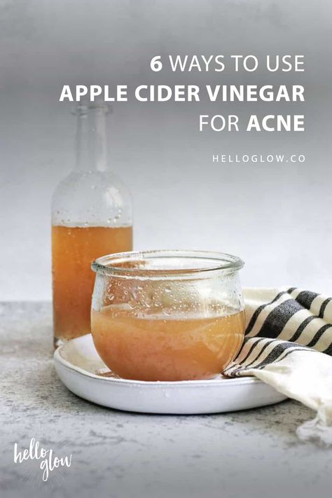 6 Ways to Use Apple Cider Vinegar for Acne Apple Cider Vinegar For Acne, Skin Care Routine For 20s, Hello Glow, Cold Sores Remedies, Natural Health Care, Natural Sleep Remedies, Baking Soda Shampoo, Natural Cold Remedies, Cold Home Remedies