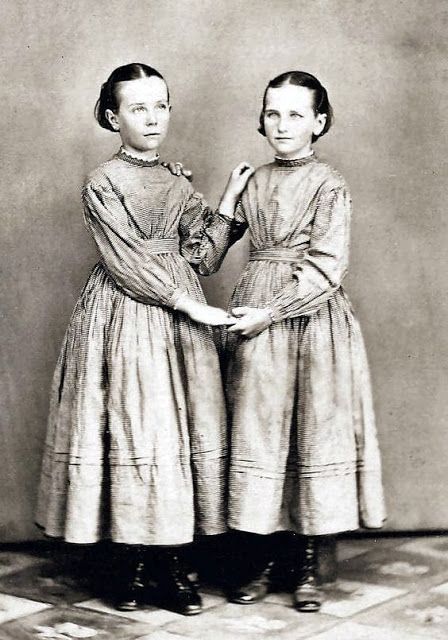 1860s Fashion, Twin Photography, Painted Eyes, Antique Photography, Portrait Vintage, Vintage Twins, Antique Pictures, Post Mortem, Childrens Dress