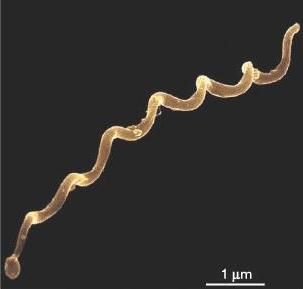 Borrelia burgdorferi Biomedical Science, Disease Control, Medical Laboratory, Microbiology, The Agency, Dream Job, Chronic Pain, Disease, Medicine