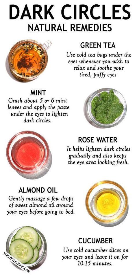 Dark Circle Remedies, Natural Skin Care Remedies, Brown Spots Removal, Glow Skin, Beauty Tips For Glowing Skin, Beauty Tips For Skin, Skin Care Remedies, Skin Care Recipes, Diy Skin Care