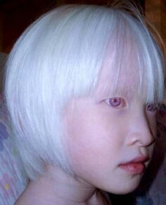 Albinism ♧ Asian Albino, Albino People, Albino Model, Albino Girl, Albino Animals, Asian Kids, Interesting Faces, 인물 사진, White Hair