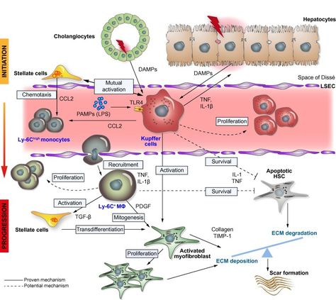 Fig. 1Hepatic macrophage heterogeneity during initiation and progression of chronic liver injury and fibrosis (mouse models). In the initial phase of hepatic injury, epithelial cell damage affecting hepatocytes or cholangiocytes perish and release Danger-Associated-Molecular-Pattern molecules (DAMPs) such as RNA, DNA, or alarmins (like HMBG-1) that activate resident Kupffer cells (KC), located at the luminal side of the liver sinusoidal endothelium (LSEC). In turn, Kupffer cells secrete pro-infl Liver Fibrosis, The Liver, Biology, Fig, Turn Ons, Models, Pattern