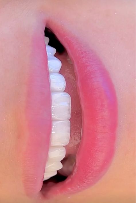 Şahin koç Hollywood smile 😉 Teeth Makeover, White Teeth Tips, Teeth Aesthetic, Pretty Teeth, Blush Pink Nails, Hollywood Smile, Cute Braces, Dental Photography, Windows To The Soul