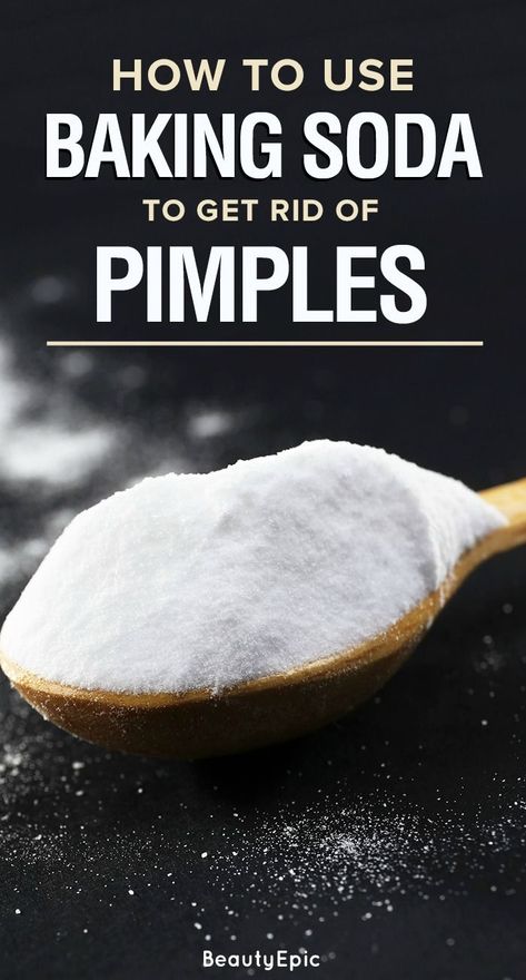 Baking Soda For Acne, Diy Shampoo Recipe, Get Rid Of Pimples, Rid Of Pimples, Forehead Acne, Baking Soda Benefits, Pimples Overnight, Get Rid Of Acne, Kidney Cleanse