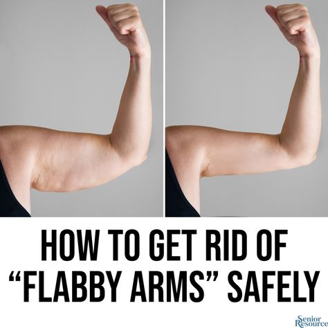 Loose skin on the arms is very common among men and women alike, but can become more prevalent as we age. How To Get Rid Of Excess Skin On Arms, Tighten Loose Arm Skin Exercise, How To Get Rid Of Loose Arm Skin, How To Tighten Loose Skin On Arms, Get Rid Of Flabby Arms, Skin Tightening Remedies, Sagging Cheeks, Home Remedies For Skin, Sleeve Surgery