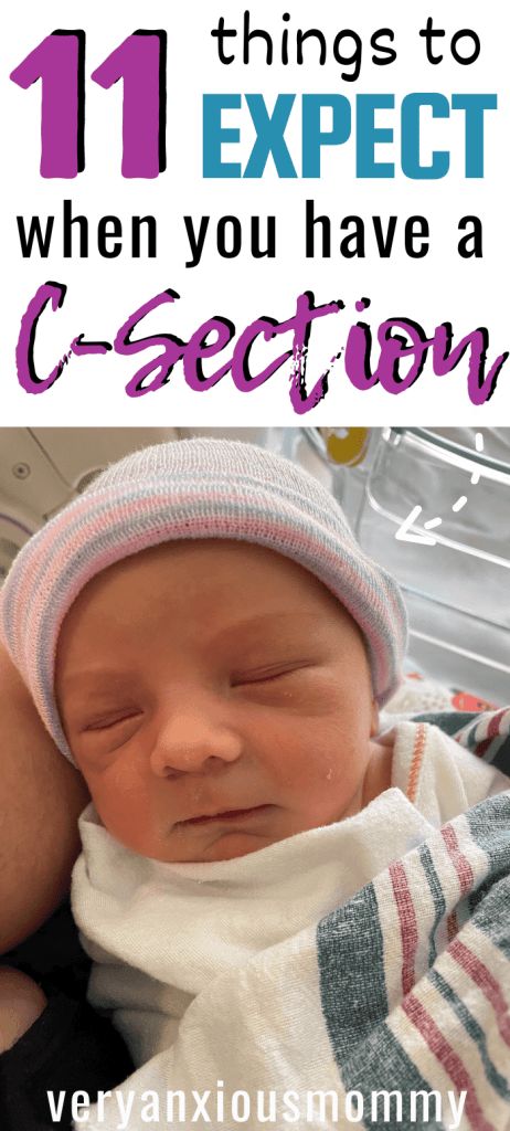 11 Secrets I Wish I Knew Before I Had My C-Section, c-section recovery, what I wish I'd known before I had a c-section, what to expect when you have a c-section, c-section birth, planned c-section, emergency c-section, scheduled c-section, csection delivery Prepare For C Section, Scheduled C Section, Birth Delivery, Emergency C Section, C Section Recovery, Natural Delivery, Baby Planning, Birth Labor, Birth Plan