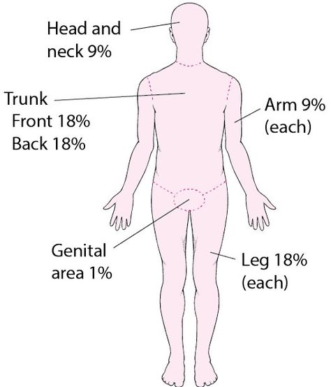 The rule of nines is a tool used to estimate a burn's percentage of your total skin. It divides your body into sections by multiples of 9% each. #Burns #FirstAid #Medicine #MedSchool Rule Of Nines, Burn Injury, Home Images, Physical Disabilities, Medical Knowledge, Occupational Therapy, Head And Neck, Book Of Life, Medical