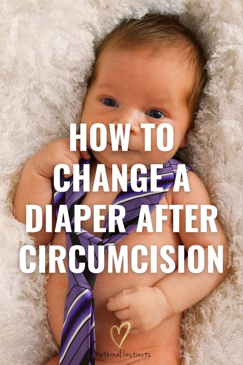 Circumcision for Newborn Boys - How to change a diaper after circumcision via @maternal_instincts Post Circumcision Care, Baby Circumcision Care, Newborn Circumcision Care, Circumcision Care Newborn, Newborn Advice, Gassy Baby, Taking Care Of Baby, Baby Information, Baby Talk