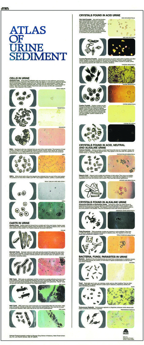 Atlas of Urine Sediment: Ear Cytology Veterinary Chart, Veterinarian Technician, Vet Tech School, Veterinary Tech, Vet Tech Student, Medical Laboratory Technician, Vet Life, Vet Technician, Medical Laboratory Scientist