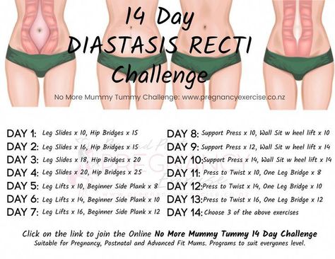 Want to heal Diastasis Recti?: Need motivation? Here is a 14 day program guide to help motivate you. Click on the link to join our 14 day No More Mummy Tummy Challenge, next round starts soon. Make sure you repin and save this one! #diastasisrecti Safe Core, Diástase Abdominal, After Baby Workout, Healing Diastasis Recti, Post Baby Workout, Mummy Tummy, Diastasis Recti Exercises, Post Pregnancy Workout, Core Challenge