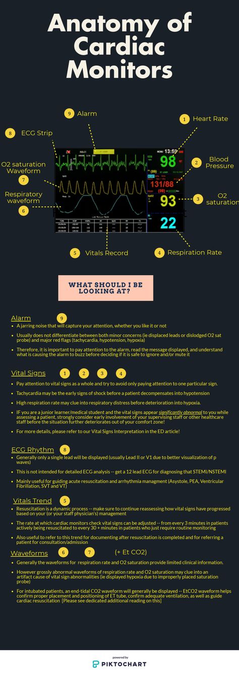 How to Read Patient Monitors - CanadiEM Vital Signs Monitor, Medical Assistant Student, Physical Therapy Student, Patient Monitor, Goblin Kdrama, Medicine Studies, Medical Student Study, Surgical Tech, Medical School Inspiration
