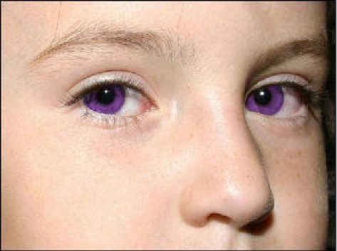 Extremely rare - Naturally Puple Eyes Red Hair Tumblr, Eye Color Facts, Rare Eye Colors, Face Parts, Rare Eyes, Camp Buddy, Genetic Mutation, Violet Eyes, Stunning Eyes