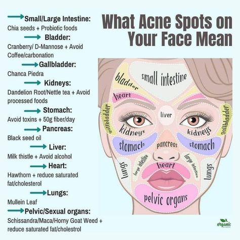 Food For Acne, Probiotic Foods, Acne Spots, Large Intestine, Improve Health, Health And Beauty Tips, Health Facts, Body Health, Health And Wellbeing