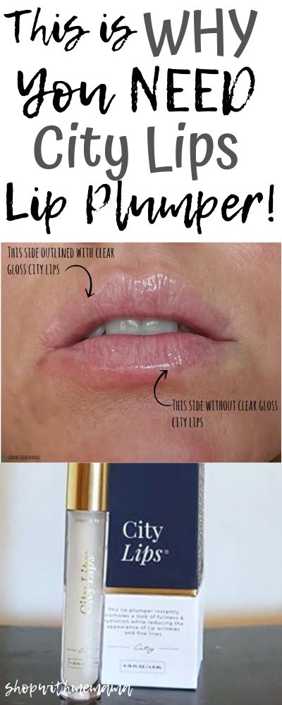 City Lips Plumper, City Lips Before And After, City Lips Buy One Get One Free, City Beauty Lips, Lip Plumpers That Work, Best Lip Plumper, Christmas Lips, 60th Birthday Ideas For Dad, Tooth Health