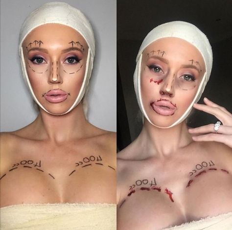 Botched Halloween Makeup, Plastic Surgery Makeup Halloween, Botched Plastic Surgeries Costume, Surgery Halloween Costume, Botched Halloween Costume, Plastic Surgery Costume, Plastic Surgery Halloween, Plastic Surgery Art, Plastic Surgery Makeup