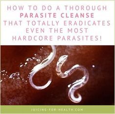 How To Do A Thorough Parasite Cleanse That Totally Eradicates Even The Most Hardcore Parasites! Parasite Cleanse Diet, Body Detox Cleanse, Parasite Cleanse, Health Cleanse, Full Body Detox, Cleanse Diet, Natural Detox Drinks, Detox Drinks Recipes, Be The Reason