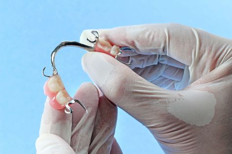 Dentist holds partial dentures for back teeth Removable Partial Denture, Losing Teeth, Dental Doctor, Denture Adhesive, Partial Dentures, False Teeth, Tooth Replacement, Dental Bridge, Natural Teeth