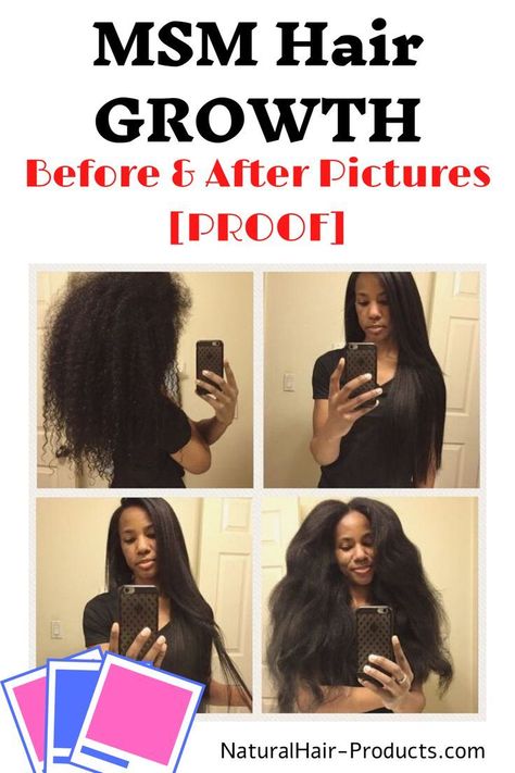 MSM Hair Growth Before and After Pictures [PROOF] biotin rice water diatomaceous earth on natural hair, diy, gel, products, cream, recipe, waves, how to use, cantu, spray care free, best, light weight without shea butter, homemade, without aloe vera. Grow hair faster in a week, long and fast. For African American Women, no castor or coconut oil. These vitamins fill in bald spots.  See healthy tips for thicker hair. NOT an overnight solution. Does not work for certain types of alopecia. Regrow Hairline, Type 4c Natural Hair, Msm Hair Growth, Tips For Thick Hair, Natural Curly Hair Care, Butter Homemade, Grow Thicker Hair, Natural Hair Growth Remedies, Black Hair Growth