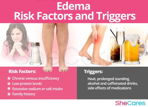 Edema How To Get Rid Of, Swelling Remedies, Edema Causes, Pitting Edema, Best Stretching Exercises, Lymph Glands, Lymph Vessels, Swollen Knee, Body Muscles