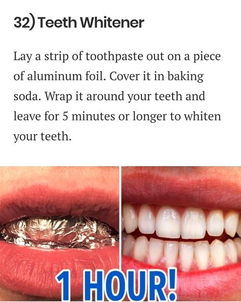 Baking Soda Teeth, Natural Teeth Whitening Diy, Natural Teeth Whitening Remedies, Baking Soda Teeth Whitening, Teeth Whitening Homemade, Teeth Whitening Remedies, Teeth Whitening Diy, Whiter Teeth, Teeth Health