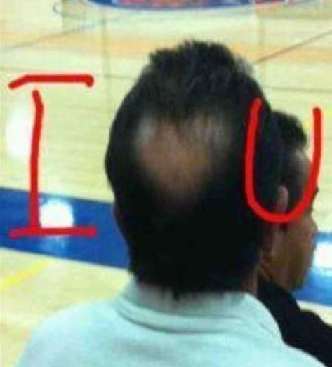 Love You, Too – 18 Funny Pics & Memes, The Strange, The Crazy, The Hilarious Heart In Nature, Bald Spot, Funny Pictures With Captions, Charlie Chaplin, Funny Love, Really Funny Pictures, You Funny, Bones Funny, Funny Photos