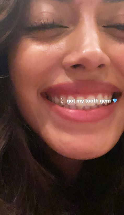 White Teeth Aesthetic, Crest Whitening Strips, Homemade Teeth Whitening, Crest White Strips, Pretty Teeth, Diamond Teeth, Perfect Teeth, Teeth Whitening Strips, Smile Teeth