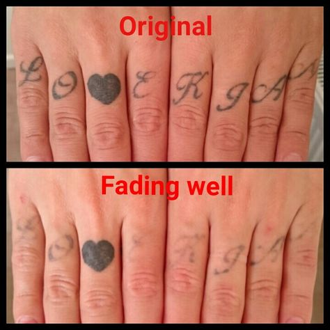 These finger tattoos have started fading away nicely. My client wants to keep the loveheart. www.the-missing-ink.co.uk  #LovingTheFade #GetRidOfYourInk #DoingItProperly #TattooRegret #TattooRemoval #LaserTattooRemoval #MissingInk #TheMissingInk #Romiley #Woodley #Stockport #Manchester #Cheshire #NorthWest Finger Tattoos Fade, Inner Finger Tattoo, Small Wave Tattoo, Palm Tattoos, Cool Arm Tattoos, Magic Tattoo, Tattoos For Black Skin, Healing Tattoo, Make Tattoo